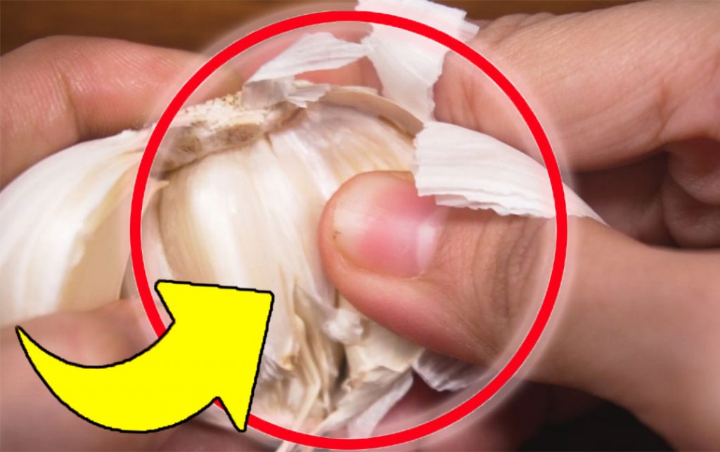 Česnek, každý si ho dává do citronové šťávy | S tímto trikem vyřešíte velmi nepříjemný problém!